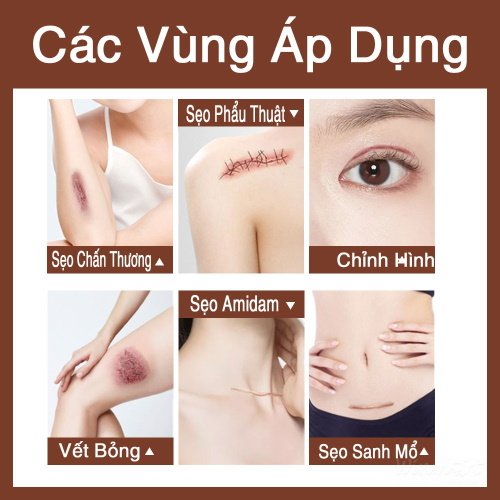 kem trị sẹo_WinMart