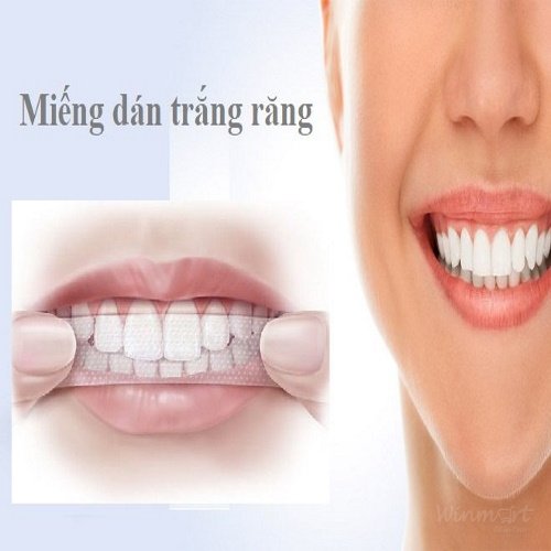 miếng dán trắng răng_Winmart.onl